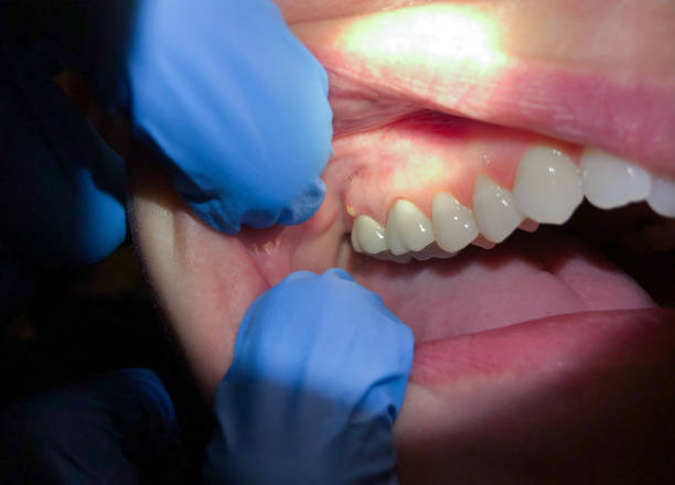 Best Emergency Gum Pain Relief  in Aquia Harbour, VA