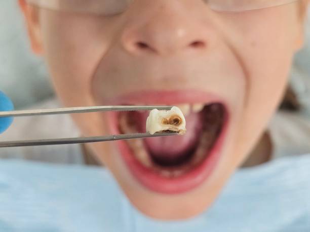 Best Tooth Infection Emergency Dentist  in Aquia Harbour, VA
