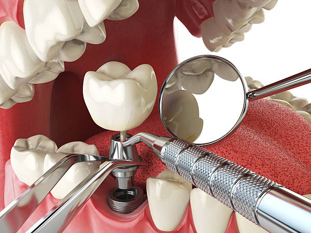 Best Affordable Emergency Dental Care  in Aquia Harbour, VA